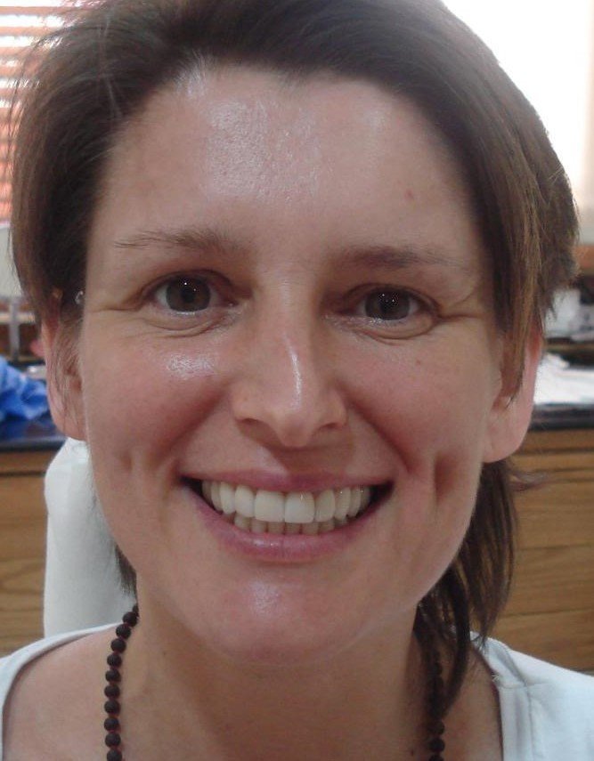 After smile makeover