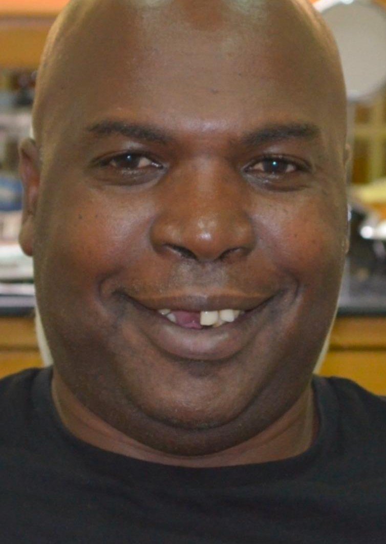 Before smile makeover