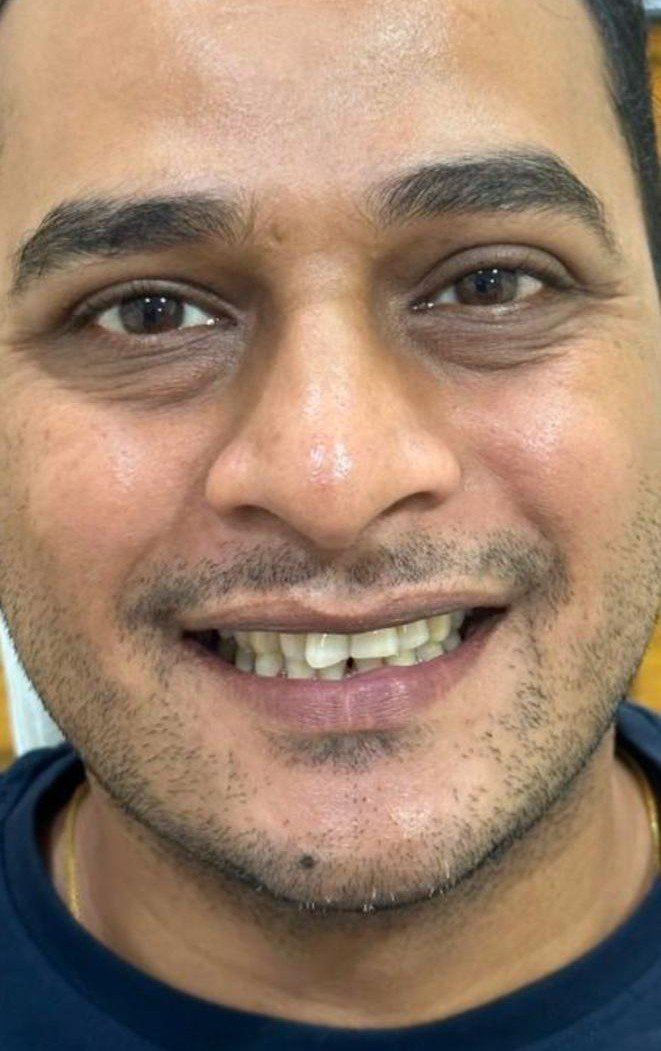 Before smile makeover