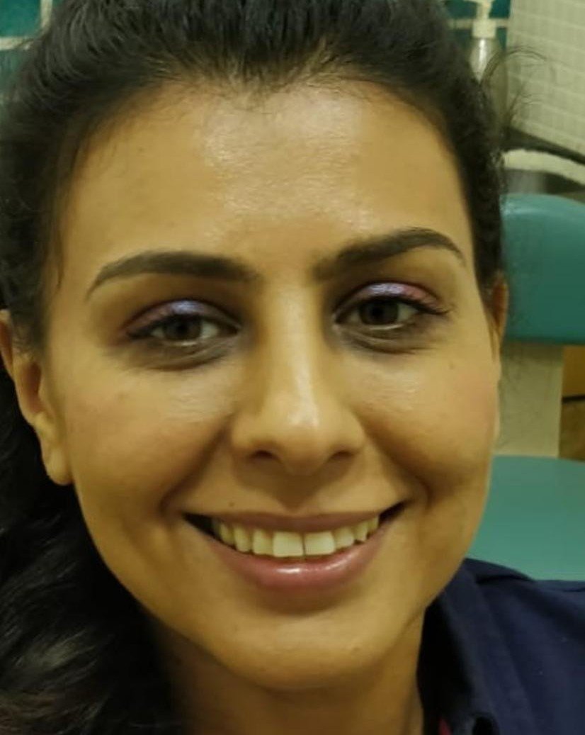 Before smile makeover