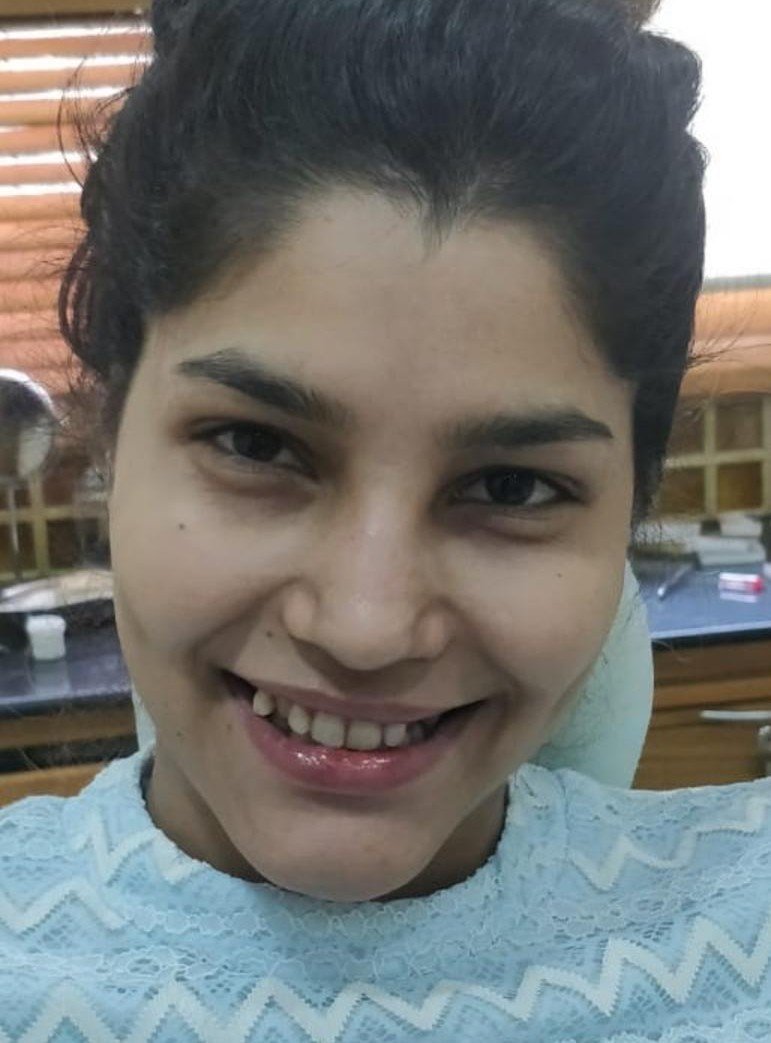 Before smile makeover