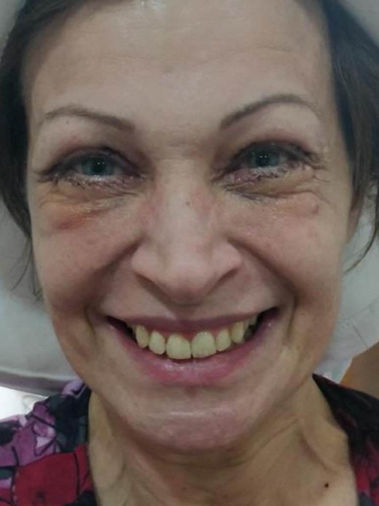 Before smile makeover