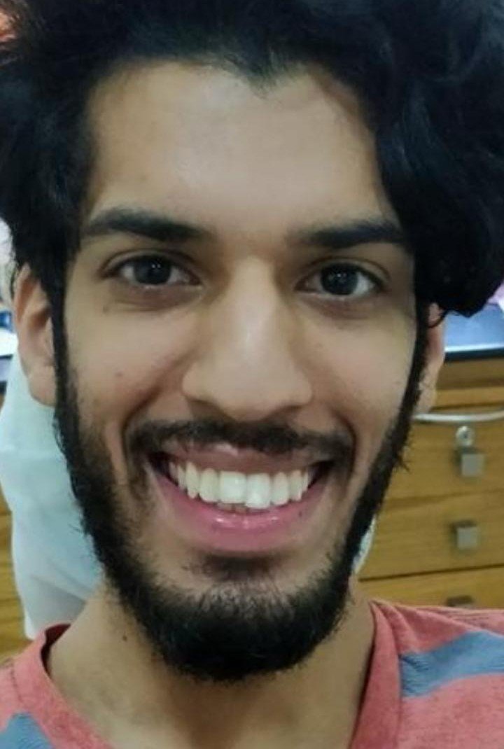 Before smile makeover