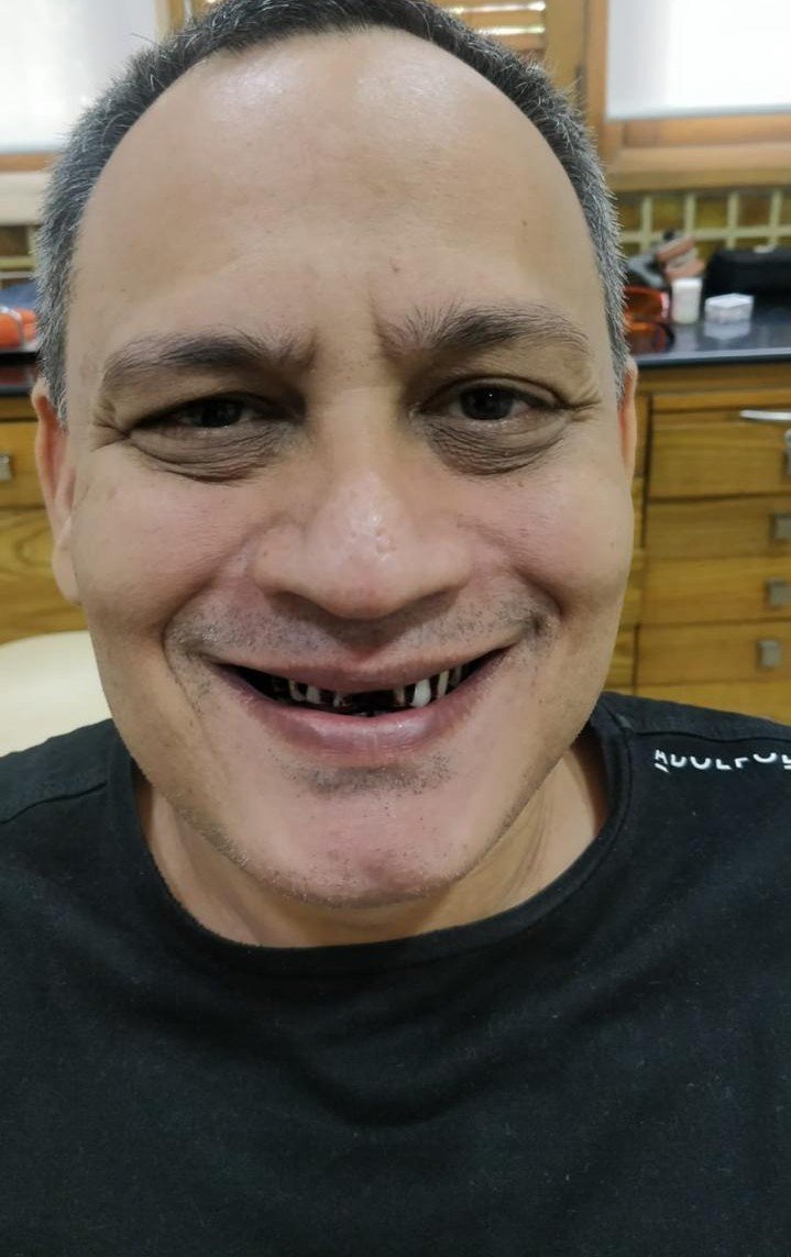 Before smile makeover