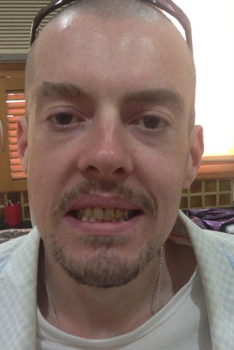 Before smile makeover