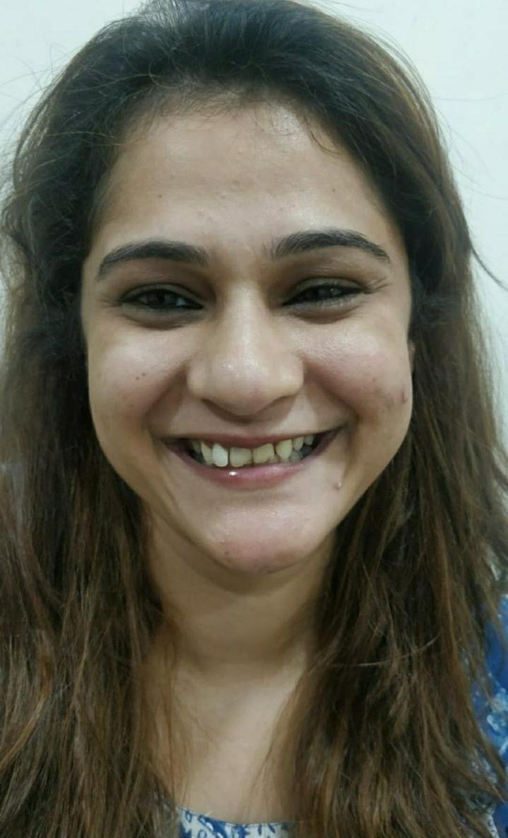 Before smile makeover