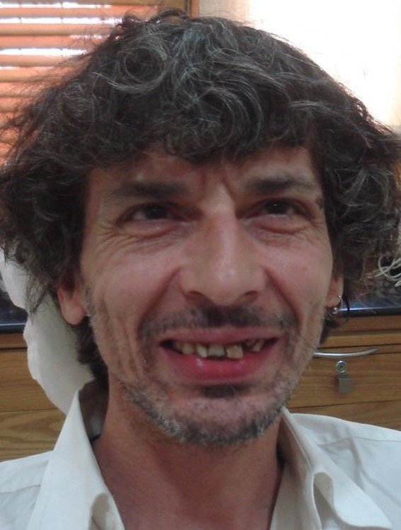 Before smile makeover