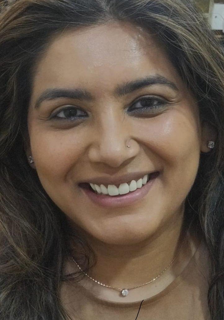 After smile makeover